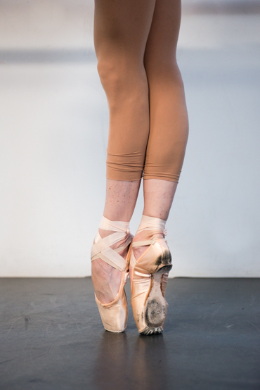 Ballerina Allynne Noelle snapped her lisfran ligament during a performance, but said adrenaline masked the pain.  Doctors replaced scar tissue in her right foot with an artificial ligament (Photo by Heidi de Marco/KHN.