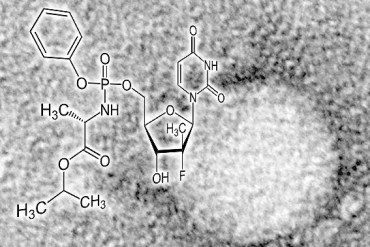 Hep C With Sovaldi 570