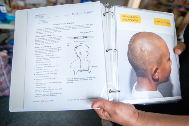Mother of Nickfredy Gutierrez, Mercedes Maldonado, holds a binder that shows an illustration of the ventricular shunt next to a photo of Gutierrez in 2009. The shunt runs from his head to his abdomen and is used to relieve pressure from his brain caused by fluid accumulation (Photo by Heidi de Marco/KHN).