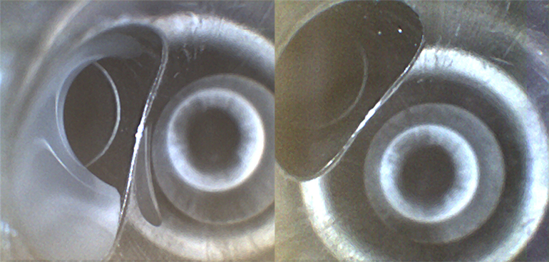 Shown on the left, whitish fluid found in the suction port of a pediatric colonoscope. The fluid contains simethicone, an ingredient in infant gas relief drops. On the right, the same scope is shown after the fluid was removed. (Courtesy of Ofstead & Associates Inc., American Journal of Infection Control)