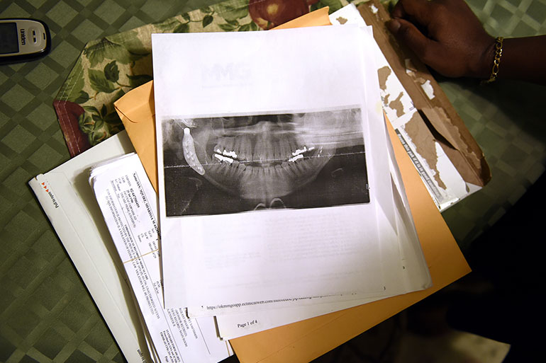 A jaw x-ray from one of Sharissa Derricott's many surgeries sits on the table at her parents’ home in Lawton, Okla. (Nick Oxford/for KHN)