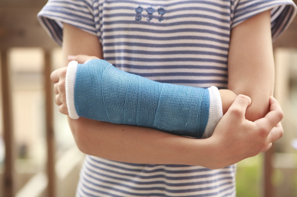 Child with arm in a cast