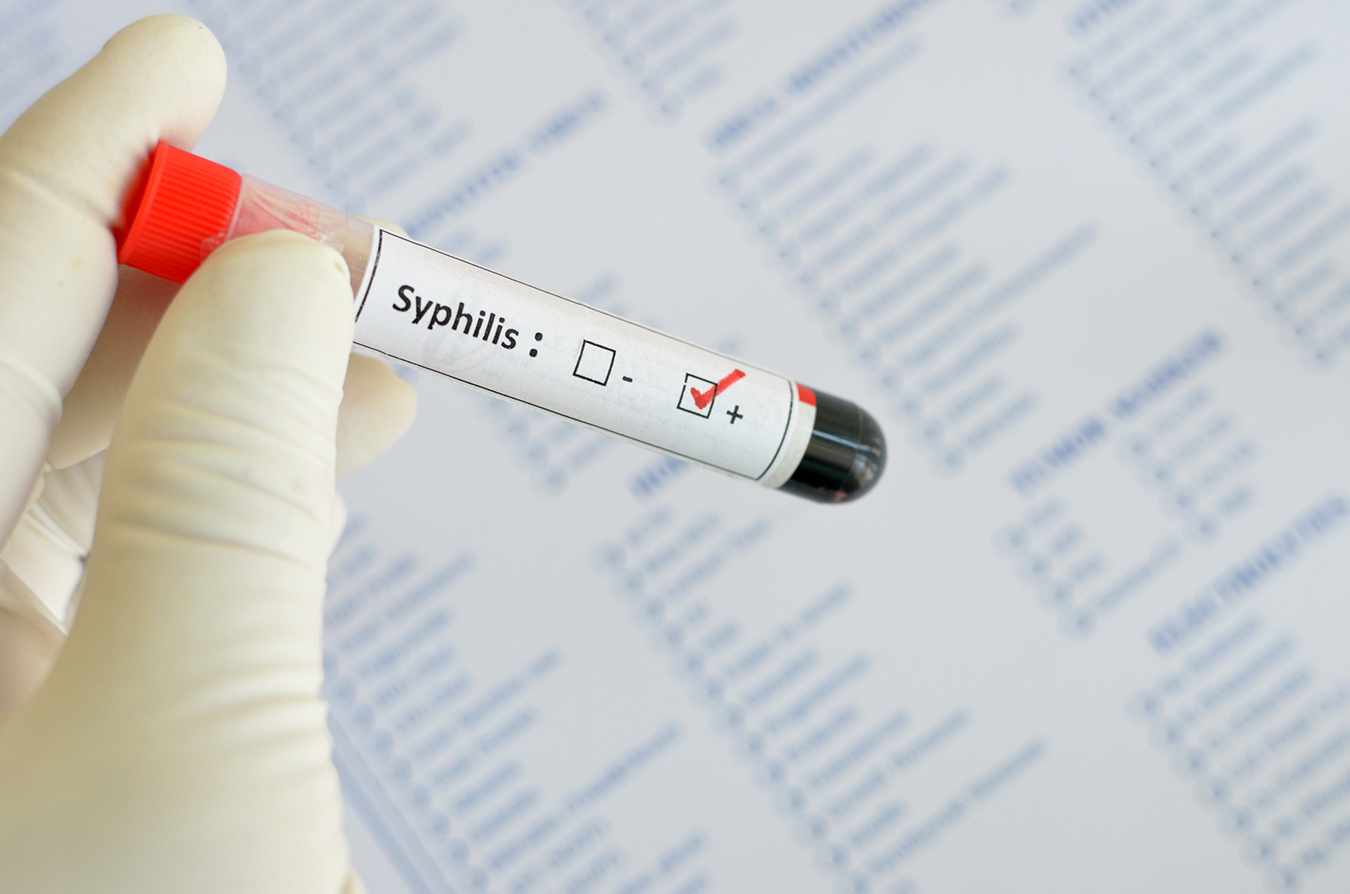 Syphilis Cases in California Drive a Record-Setting Year for STDs Nationwide