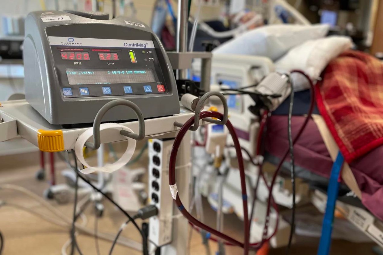 What Is a Ventilator? How the Breathing Machine Can Save Lives