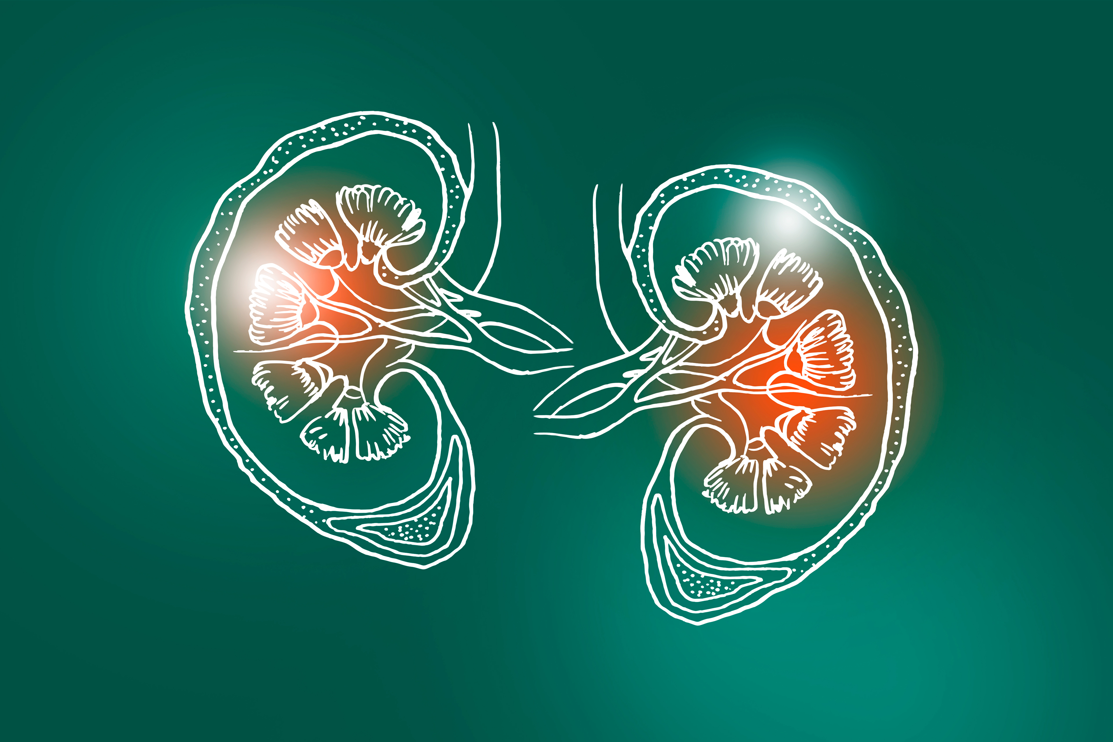 Urine Proteomics Reveal Acute Kidney Injury as a Result of COVID-19 |  Research Highlight | PNNL