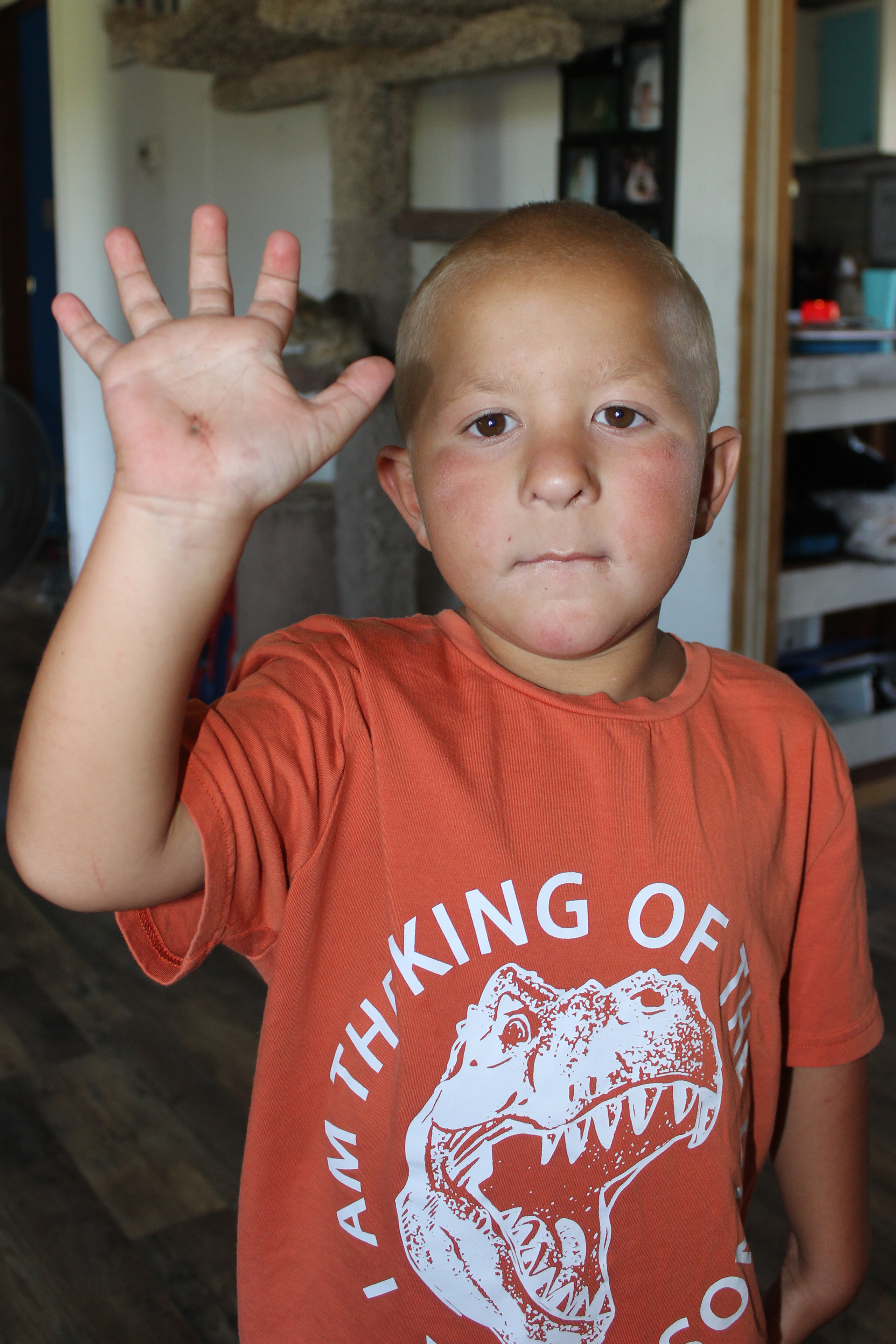 A photo shows Mason Lester raising his hand to show an injury on it.