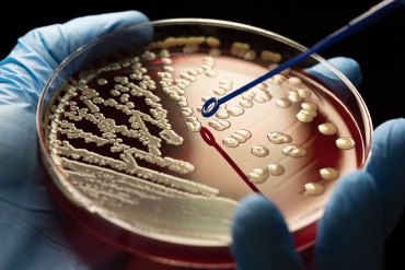 A gloved hand holds a blood agar plate filled with colonies of MRSA bacteria.