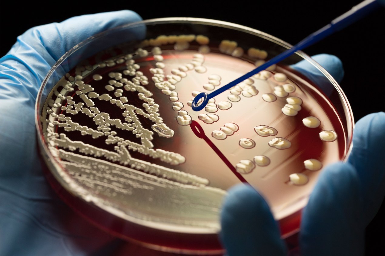 A gloved hand holds a blood agar plate filled with colonies of MRSA bacteria.
