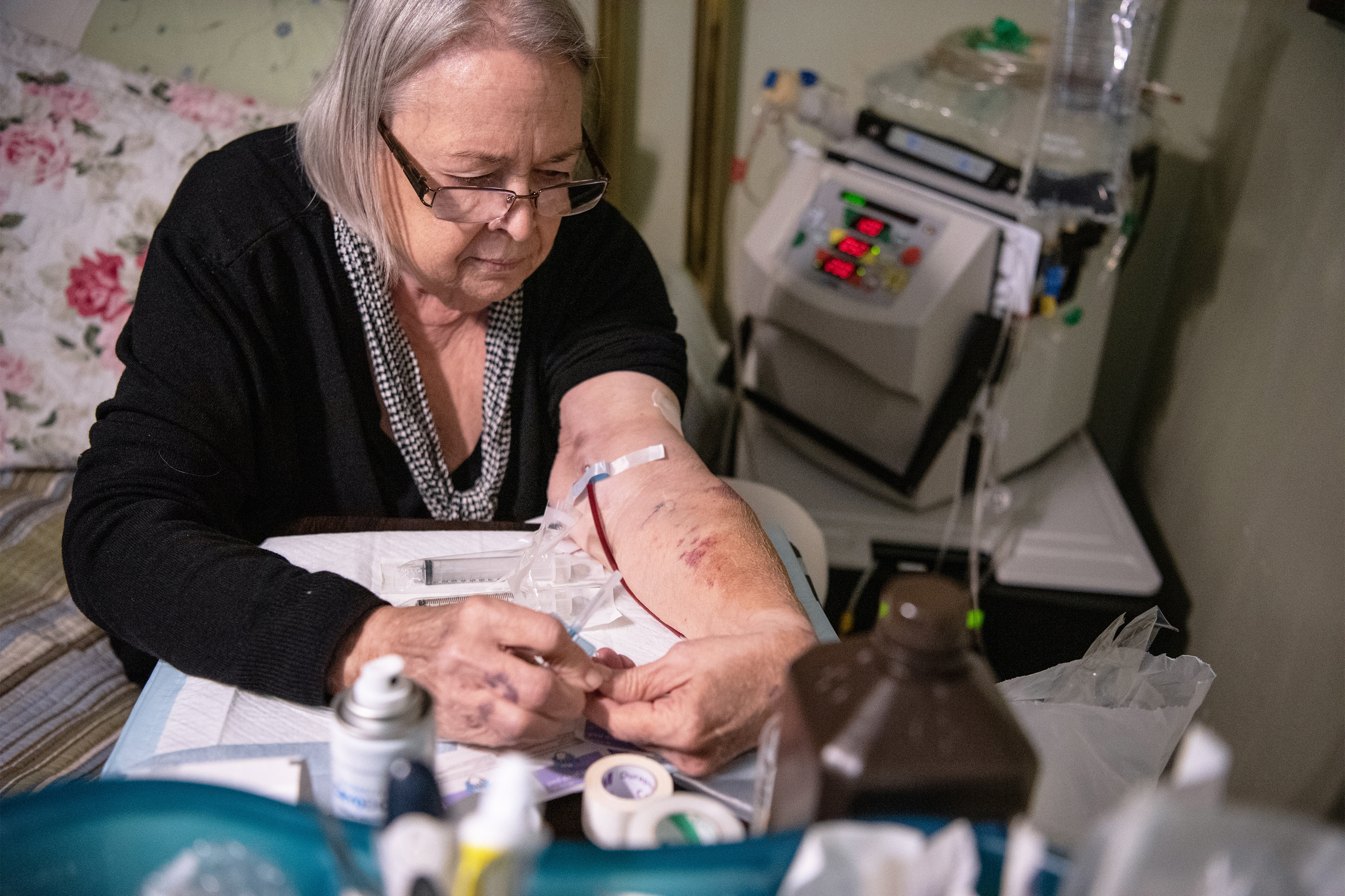A photo of Nieltje Gedney using a needle to cycle her blood through a hemodialysis machine.