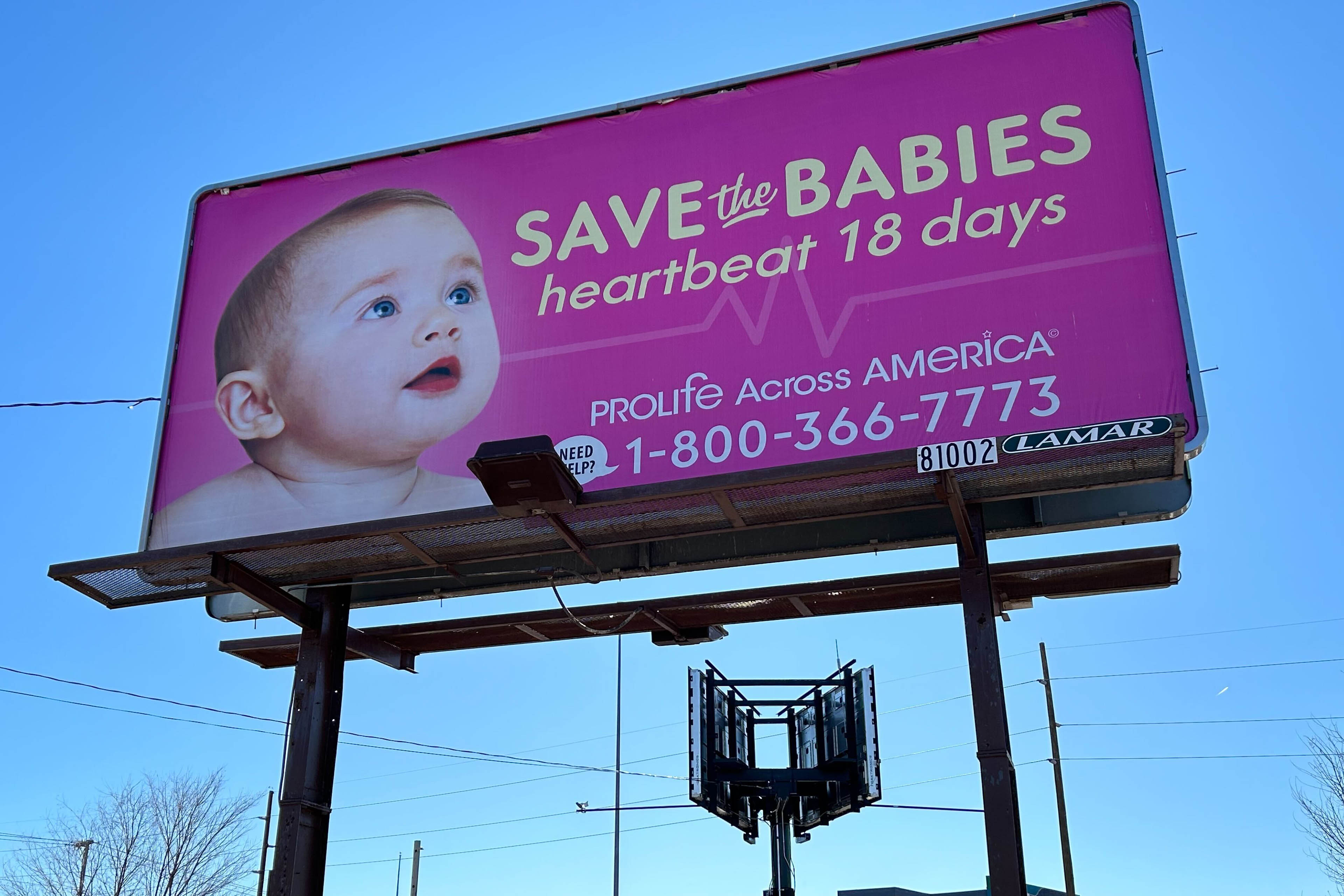 An anti-abortion billboard.