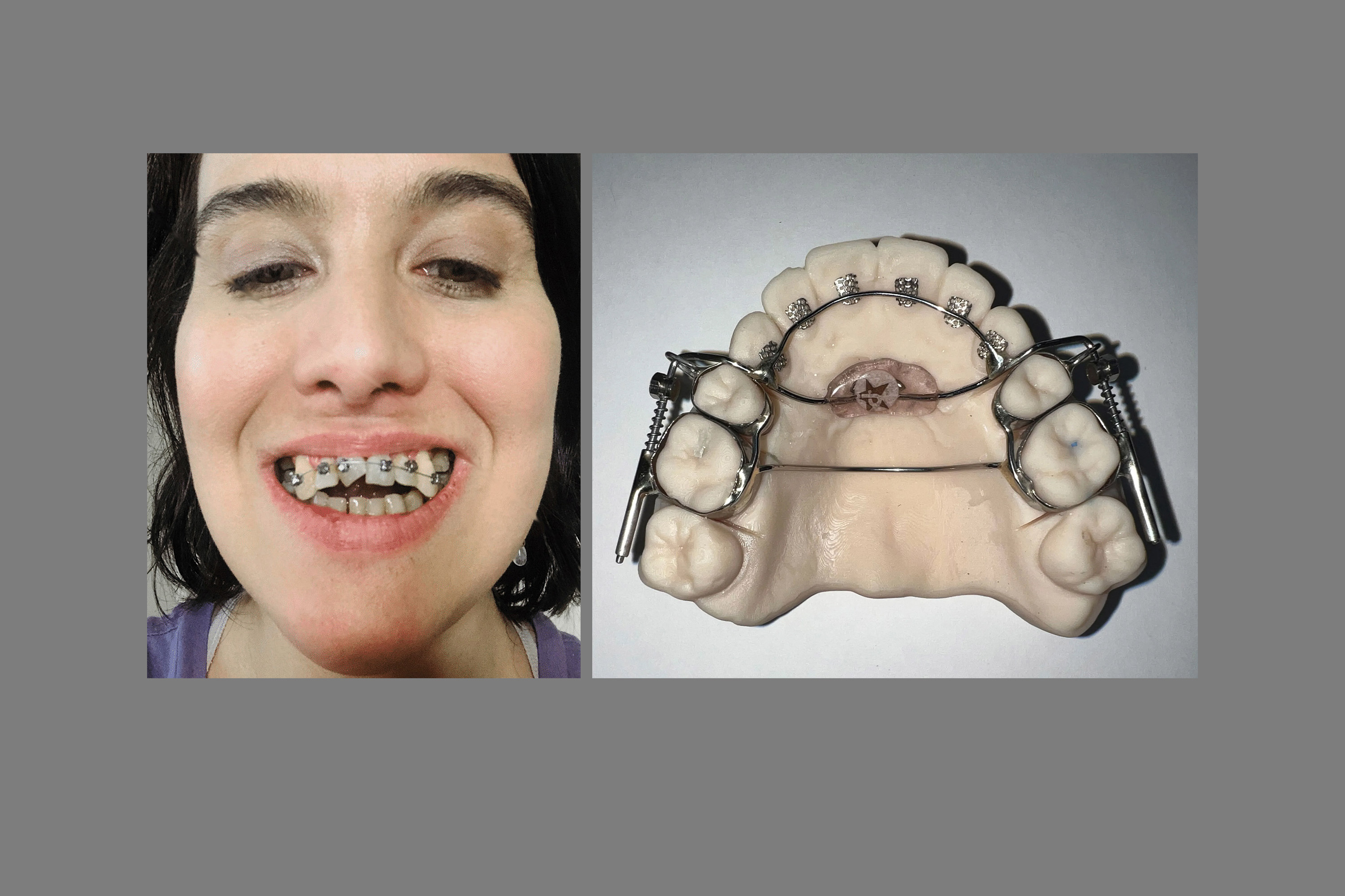 FDA Said It Never Inspected Dental Lab That Made Controversial AGGA Device