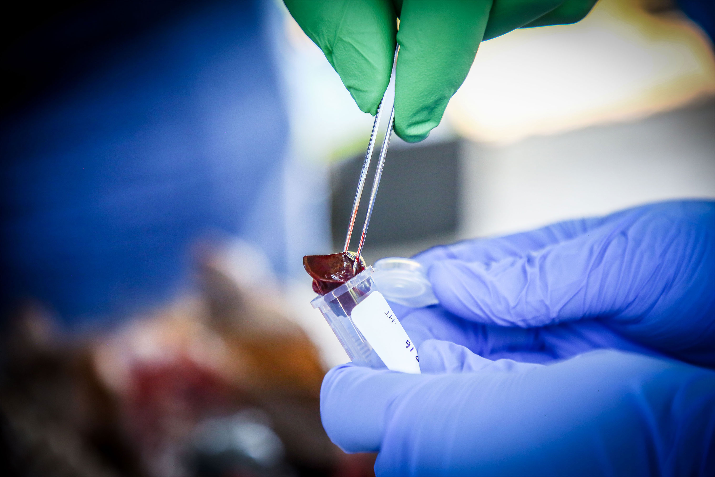 A photo of gloved hands putting a sample of tissue in a vial.