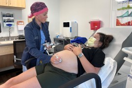 Taylar Swartz uses an ultrasound scanner on a pregnant patient's belly.