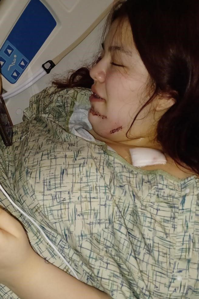 An up-close photo of a girl in a hospital bed, showing injuries to her jaw.