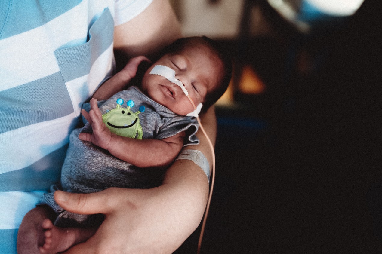 A premature newborn is cared for in the neonatal intensive care unit while being held in a person's arms.