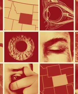 A collage of images of eyes, a scalpel, and maps of Colorado, Wyoming, and Ireland.