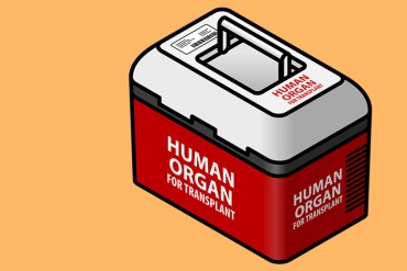 organ transplant_770