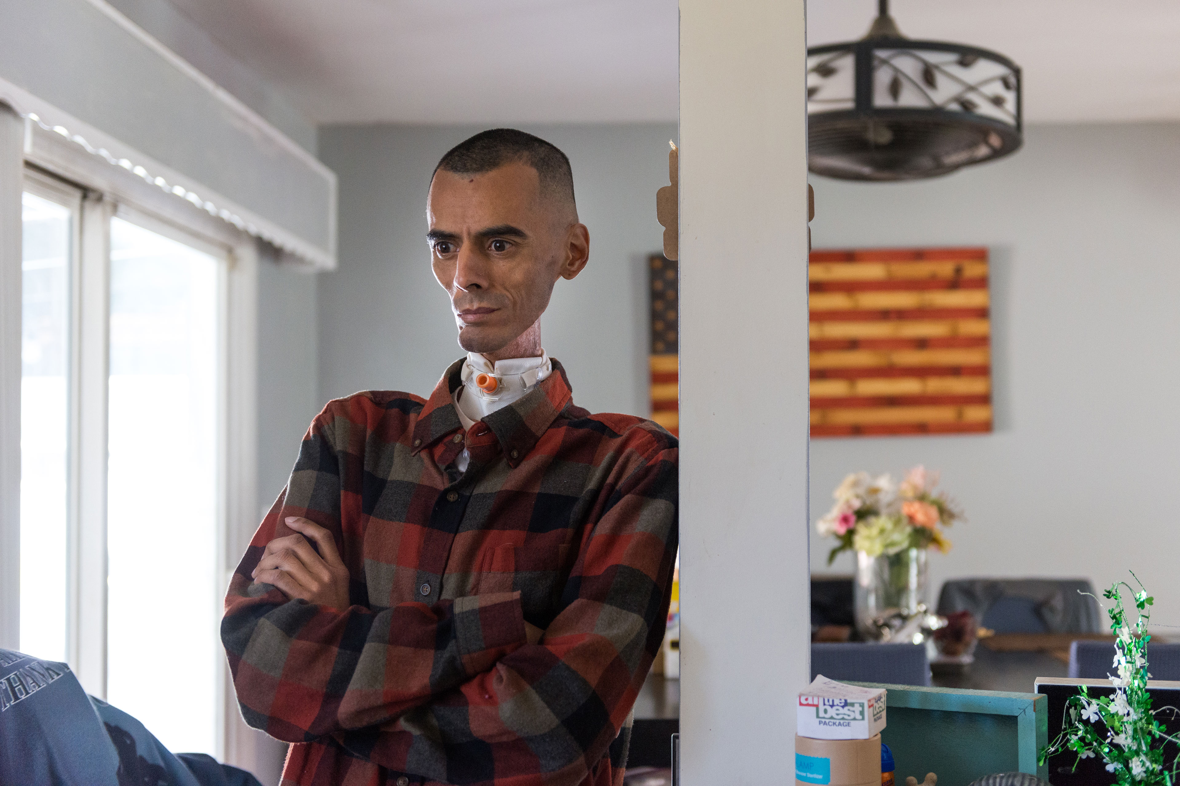 A gaunt man with a tracheostomy leans against a support column in his home.