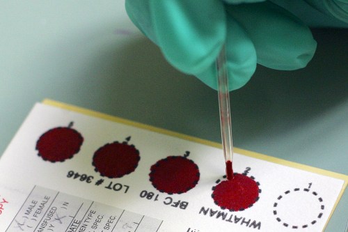 A photo shows a sample of heel-stick blood being tested.