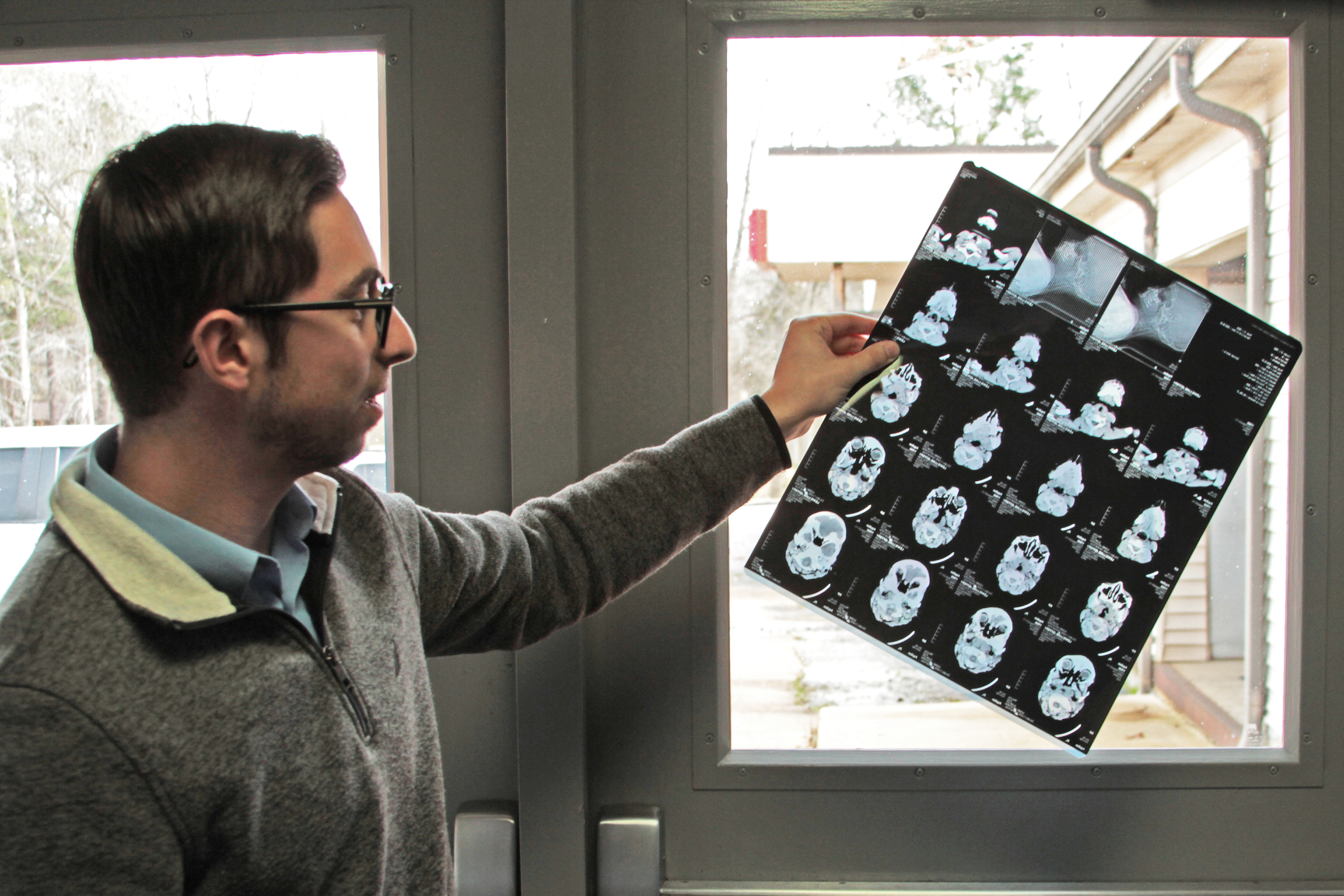 A photo shows Kyle Kopec holding a medical record up to the light by a window.