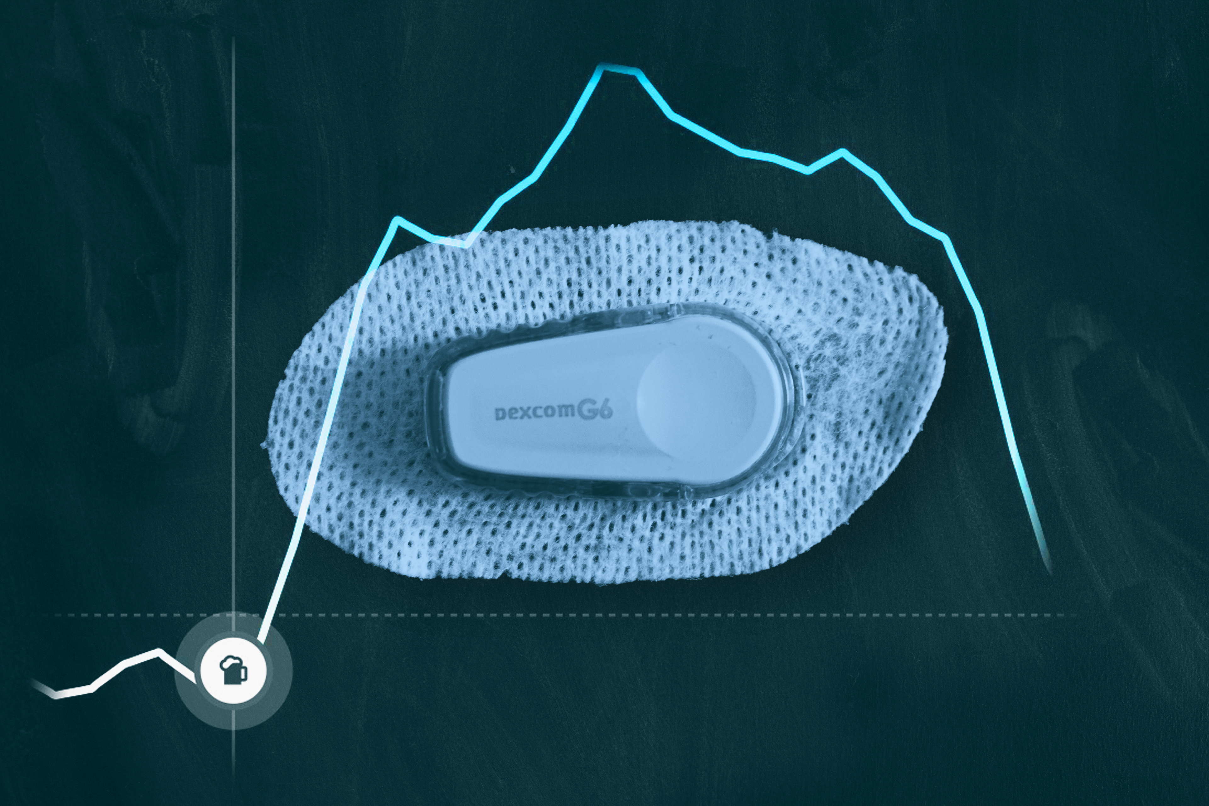A photo illustration shows a Dexcom continuous glucose monitor with a rising and falling blood glucose reading superimposed on top of it.