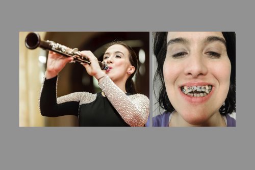 This Dental Device Was Sold to Fix Patients’ Jaws. Lawsuits Claim It Wrecked Their Teeth.