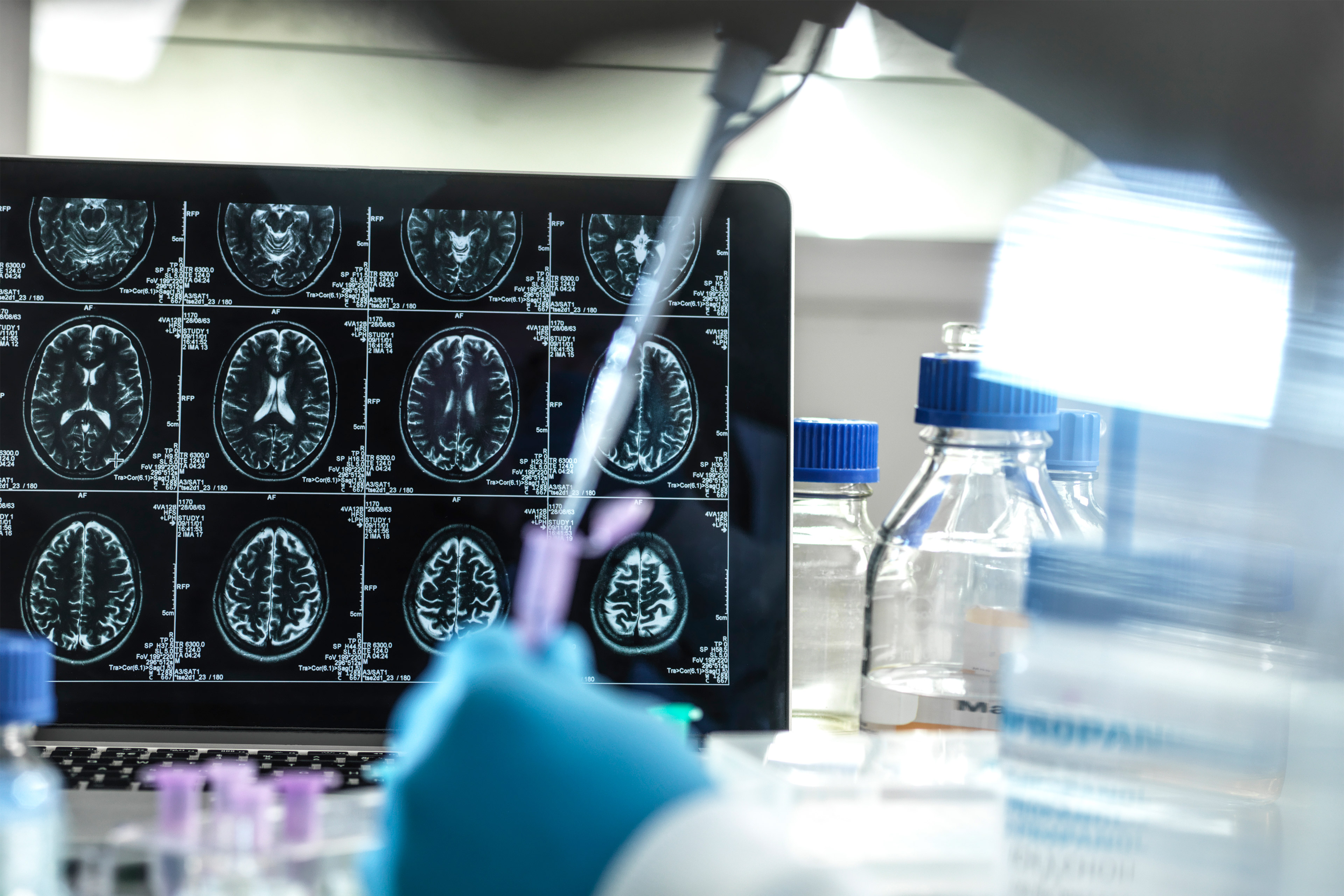 A photo of a person working in a lab on pharmaceuticals. An MRI scan printout is seen in the background.