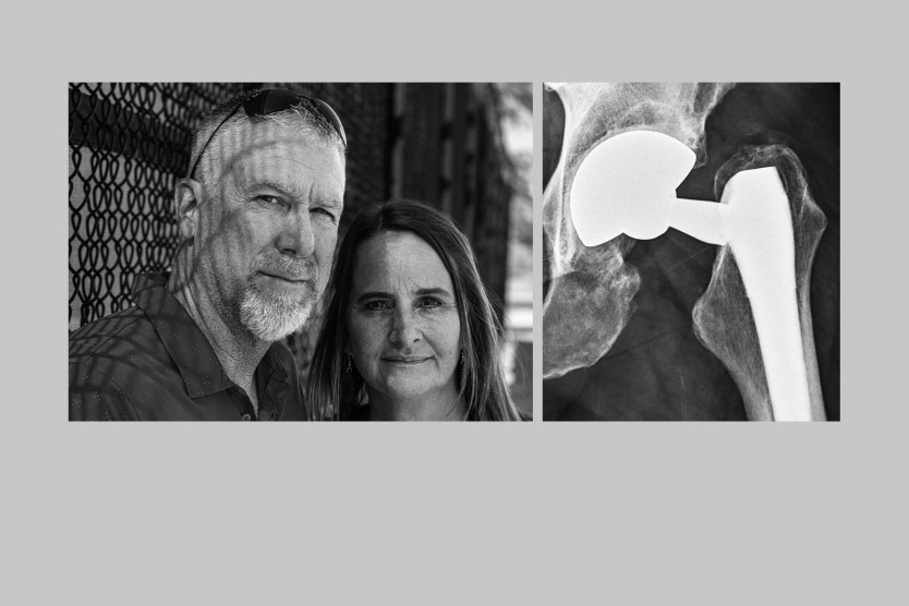 Two photos shown side-by-side: On the left, a portrait of a man with his wide; on the right, an x-ray of a broken artificial hip.