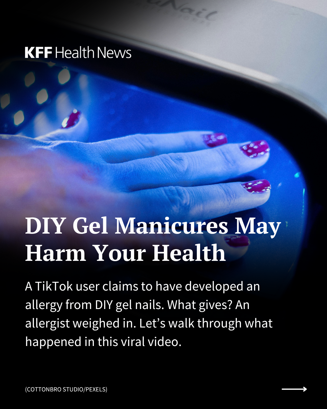 An Instagram slide where the background is the image of a hand with nail polish under a blue light. The text on the slide reads: "DIY Gel Manicures May Harm Your Health. A TikTok user claims to have developed an allergy from DIY gel nails. What gives? An allergist weighed in. Let’s walk through what happened in this viral video."