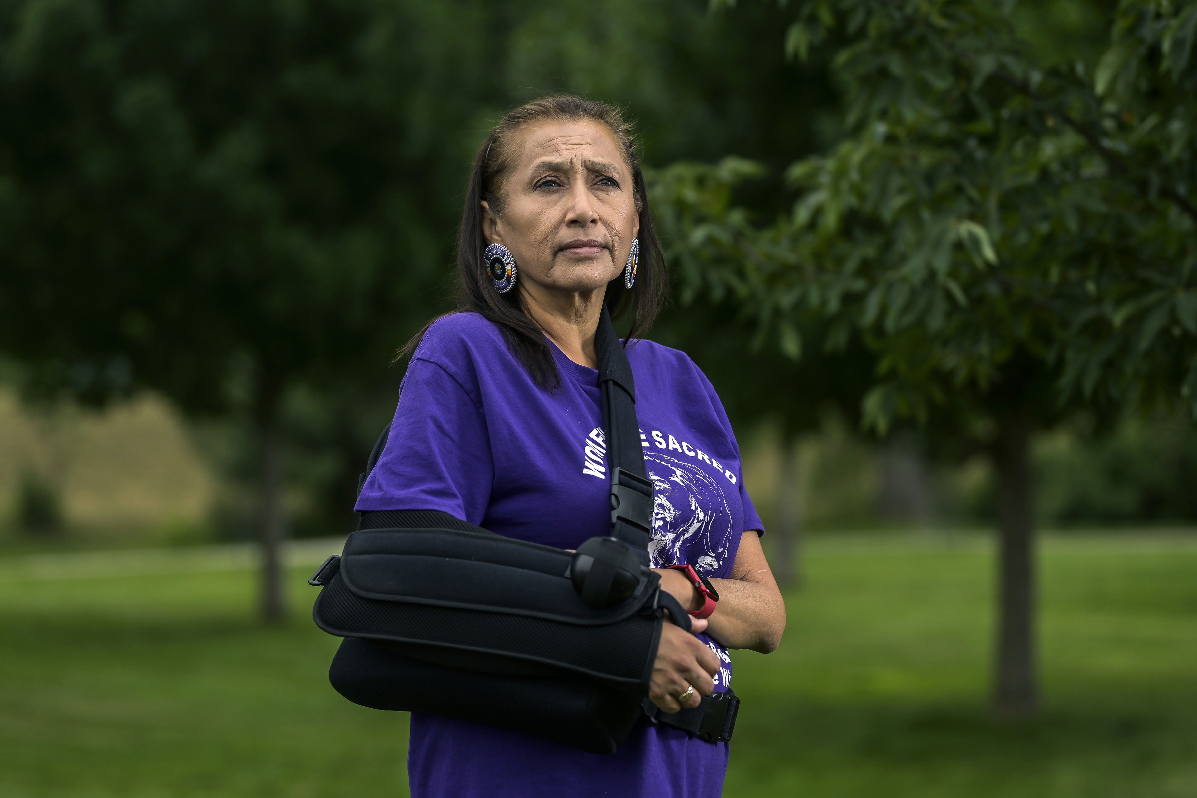 A woman with a protective sling on her arm stands outside to have her portrait taken.