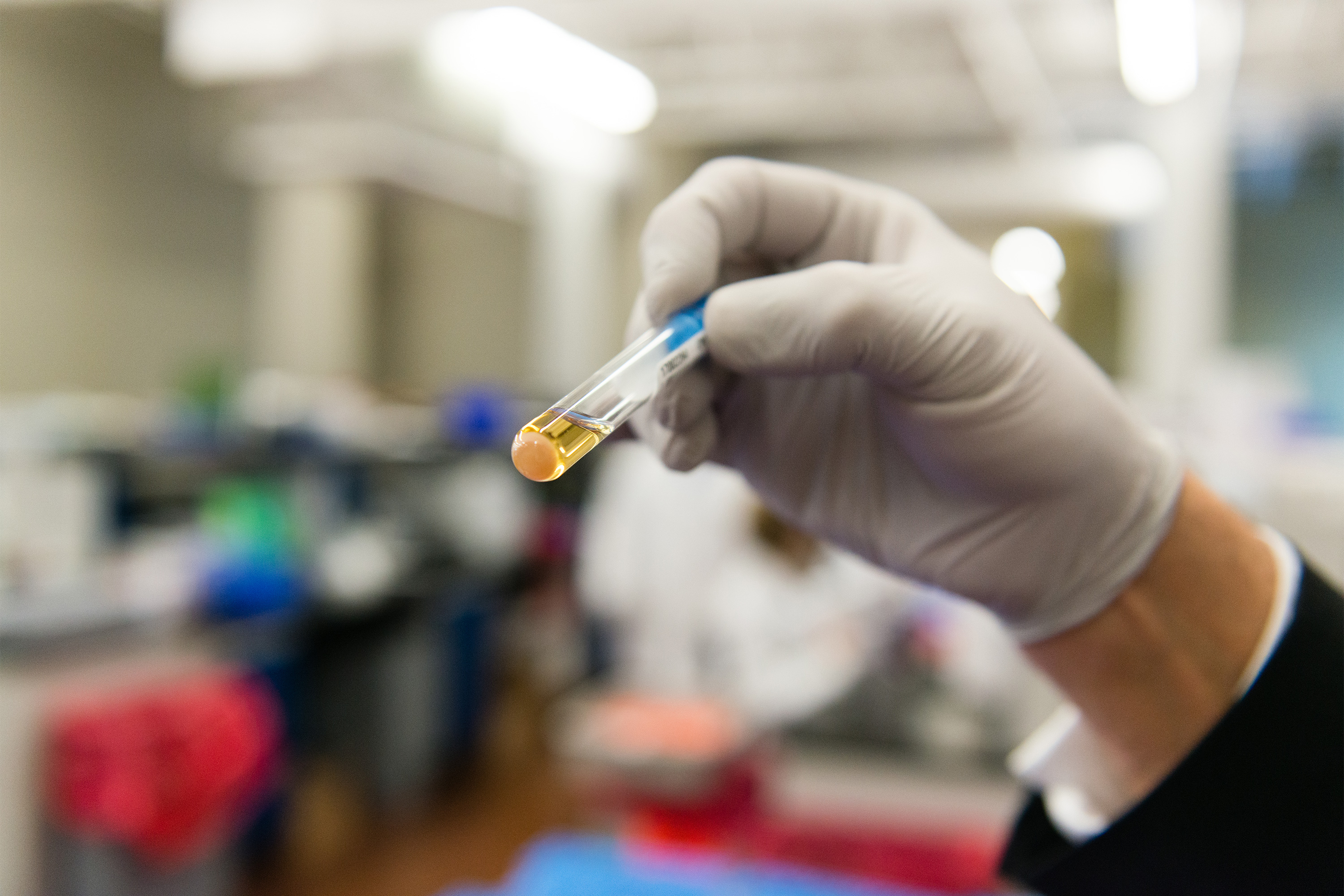 A photo of a vial of urine being held up by a gloved hand in a laboratory.