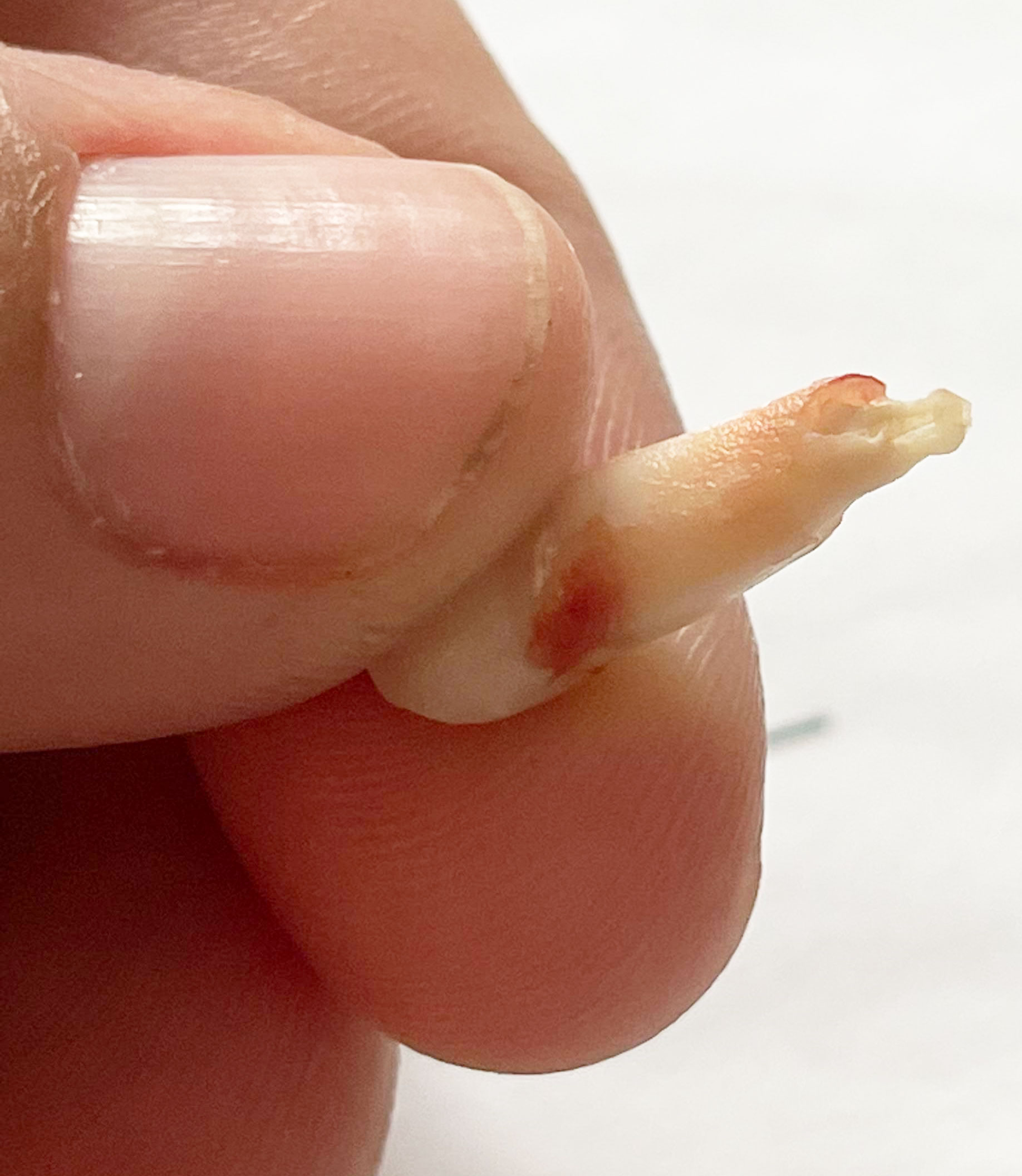 A hand holds up an extracted tooth.