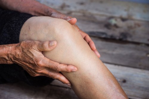 A close-up photo of an older person's hands clutching their knee.
