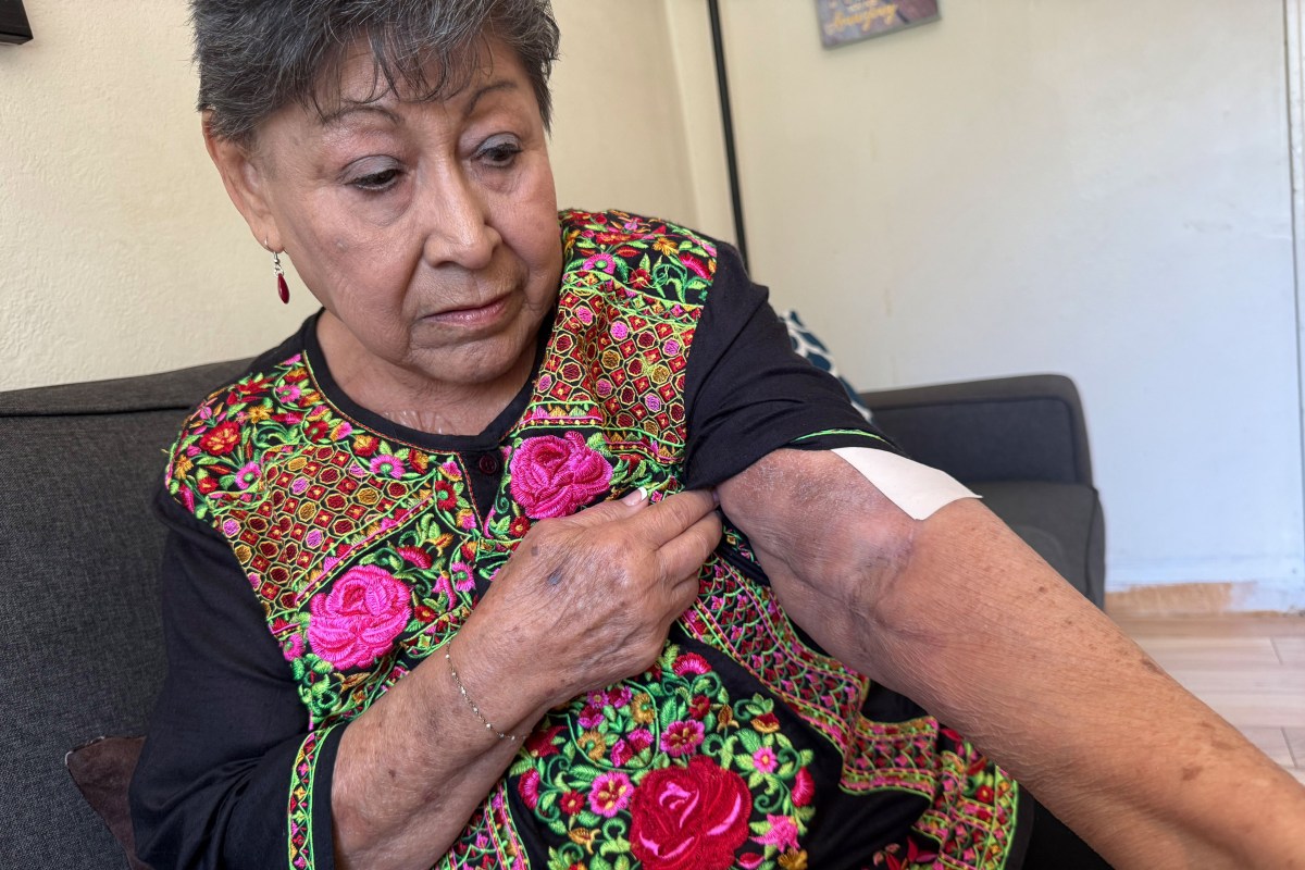 A senior woman shows the place on her arm where her blood pressure cuff goes.